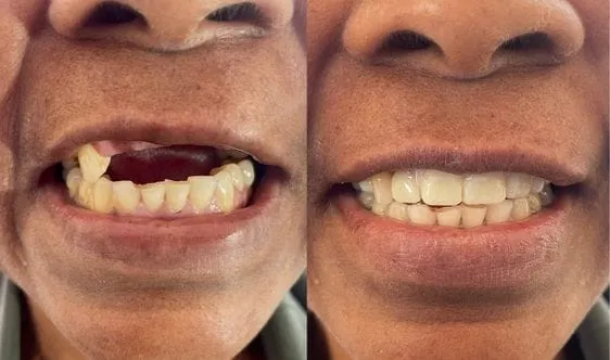 Before and after a patient's dental treatment