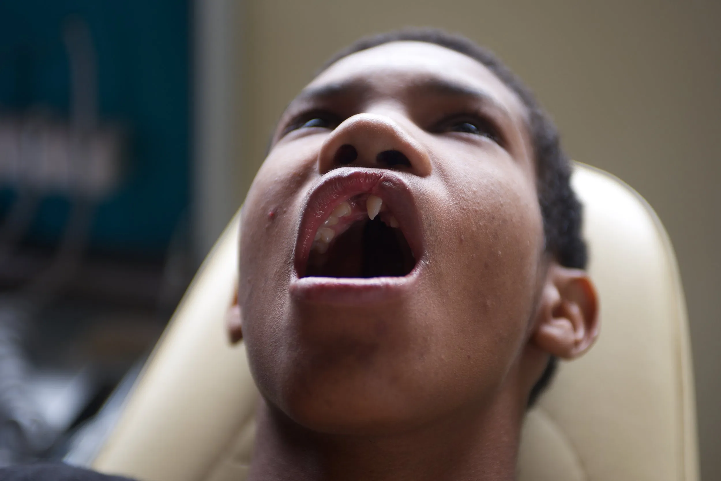Untreated dental disease is common where there is no access to a dentist