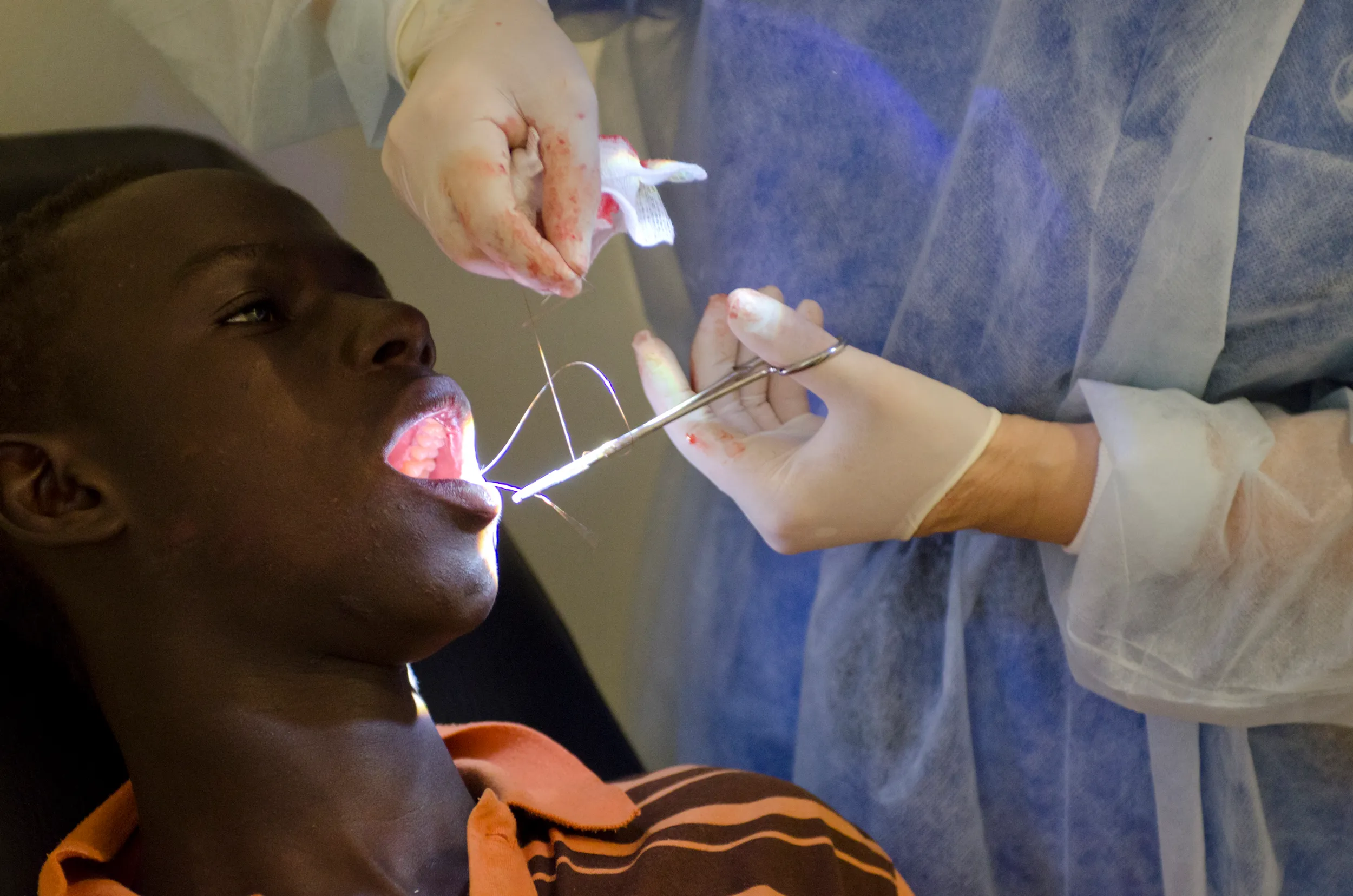 An extraction — acute care is the clinic's priority
